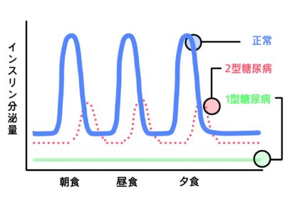 炭水化物制限でインスリン分泌機能が改善？気をつけたいこと。のアイキャッチ画像