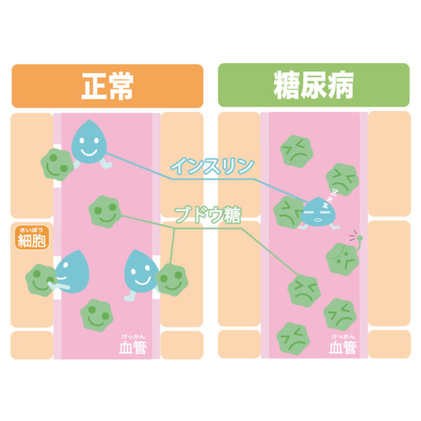 血糖値って何？