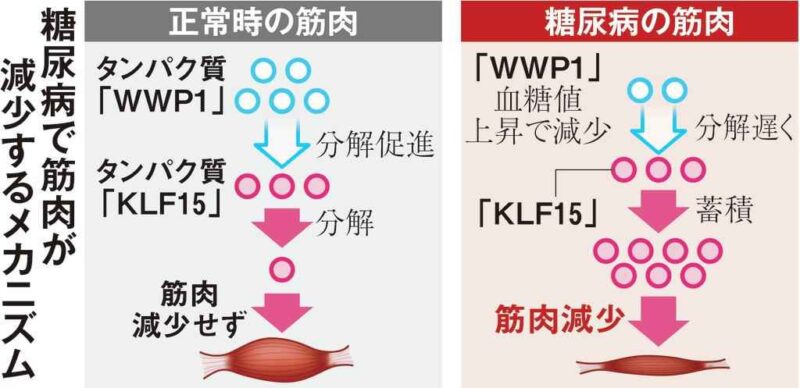 糖尿病とサルコペニアの関係